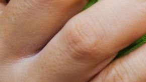 El sarampión puede poner en peligro la vida de tu hijo.