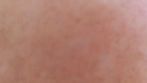 smoking-1026556_1280