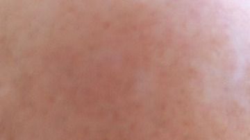 smoking-1026556_1280