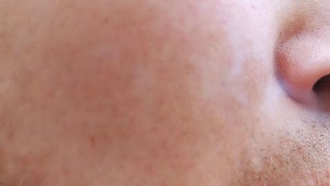 smoking-1026556_1280