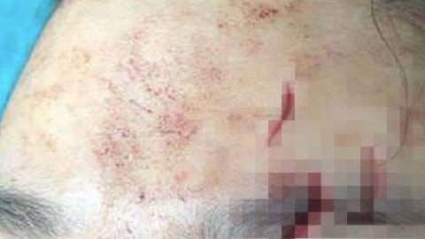 La mujer aún no termina de negociar los términos de la compensación.