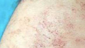 La mujer aún no termina de negociar los términos de la compensación.