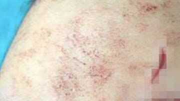 La mujer aún no termina de negociar los términos de la compensación.