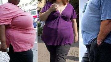 Las consecuencias de la obesidad son enfermedades.