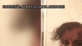 “Me agredieron muy feo, es algo que no quisiera volver a vivir...", dijo Escobar Andrade.