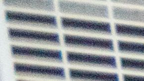 Jackson Moss has diabetes. He had to stop working after his left leg was amputated below the knee about 10 years ago because of an infected wound that developed in his toe. (Heidi de Marco/Kaiser Health News)