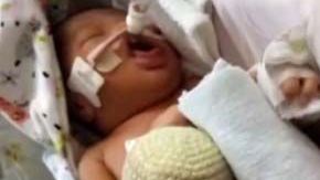 El bebé se encuentra entubado.