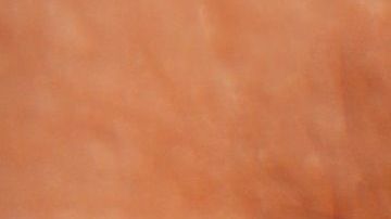 Todos tenemos estos bichos en la cara.