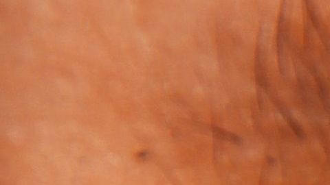 Todos tenemos estos bichos en la cara.