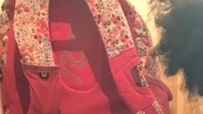 Loanny padede del Síndrome Nefrótico.