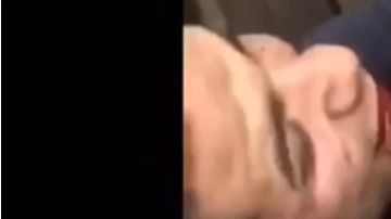 La víctima con el rostro herido