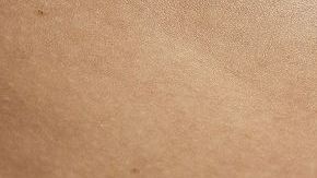 El hombre trans padecía obesidad y por eso descartaron un embarazo.