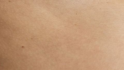 El hombre trans padecía obesidad y por eso descartaron un embarazo.