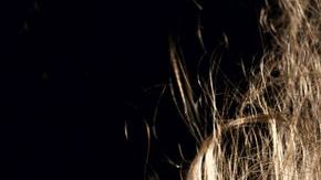 Cuando el problema es mayor o si sencillamente deseas eliminarlo desde los inicios, puedes seleccionar uno de los muchos tratamientos que actualmente existen.