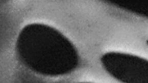 El implante late como un músculo cardíaco.