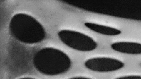 El implante late como un músculo cardíaco.