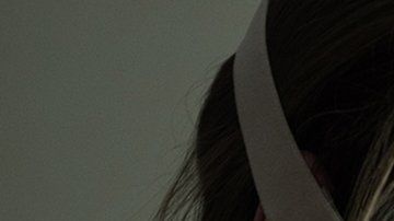 Vicky Knight odió sus cicatrices desde que era niña.