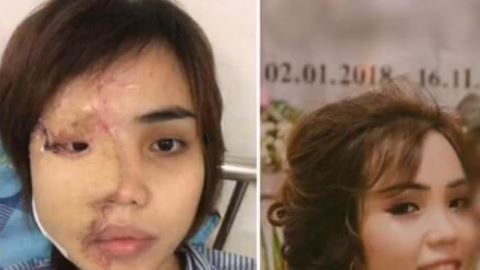 Jamás se imaginó que sería atacada por quien creía era el amor de su vida.