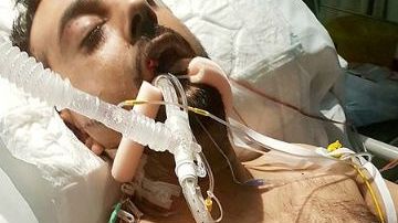 Sajed Choudry quedó en coma.