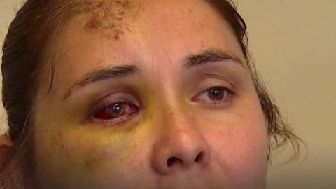 Berónica Ruiz tras el ataque