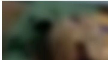 Los médicos aseguran que este hombre sobrevivió de milagro.