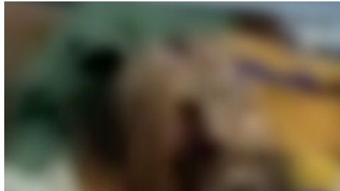 Los médicos aseguran que este hombre sobrevivió de milagro.