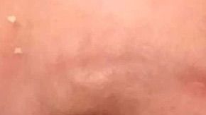 El niño fue contagiado del virus del herpes simple.