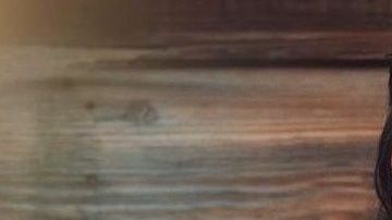 Gracyanne-Barbosa-vai-parar-no-hospital-apos-esmagar-os-seios