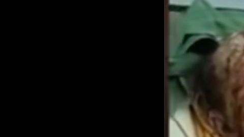 El paciente de psoriasis