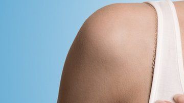 El cáncer de mama es más difícil de detectar en mujeres con senos densos.