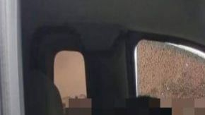 Así quedó expolicía de Tijuana tras lluvia de balas que sicarios le lanzaron