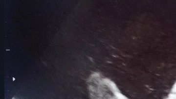 Lo que sería una revisión de rutina se convirtió en un hecho que nunca olvidarán.