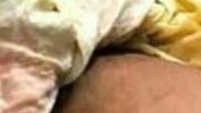 Bebé nació con una protuberancia llamada comúnmente "cola de ratón".