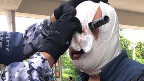 Herido con cuchillo por un lugar de estacionamiento