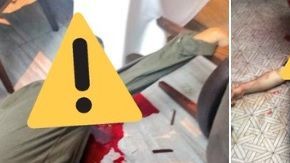 Fue un ataque directo, dijeron las autoridades.