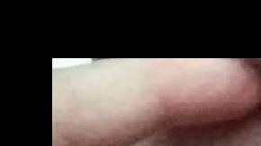 Nick Humphreys muestra su ojo dañado.