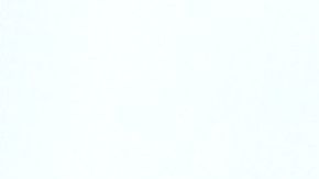 Ortodoncia-invisible-alineadent