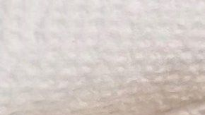 Pajarito herido fue llevado en Uber al veterinario.