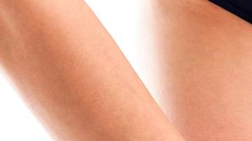 El consumo de alcohol y tabaco son agentes que promueven la aparición de celulitis.