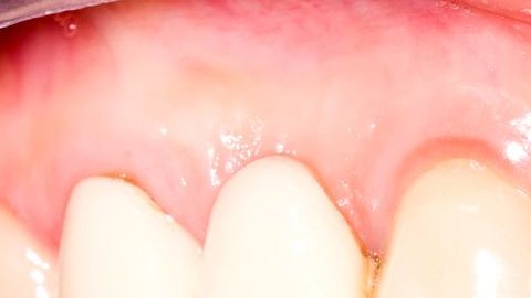 shutterstock_129331382