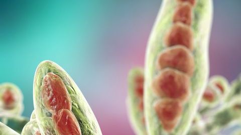 Una infección por hongos.