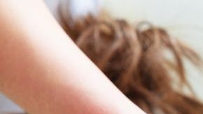 Un corto circuito le provocó graves quemaduras.