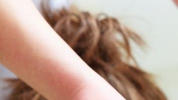 Un corto circuito le provocó graves quemaduras.