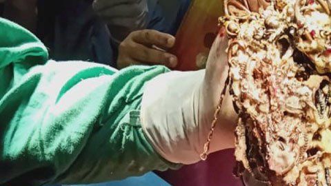 Una mujer come joyas y enferma gravemente.