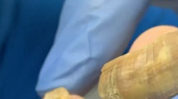 Los hongos en las uñas de los pies aparecen por mantenerlas húmedas y calientes.