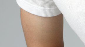 Las piedras o cálculos en el riñón pueden ser muy dolorosos.