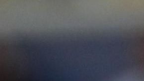 Cristiano Ronaldo se ha sometido, al menos, a 5 cirugías estéticas.