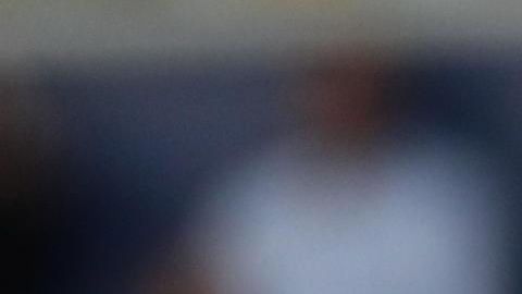 Cristiano Ronaldo se ha sometido, al menos, a 5 cirugías estéticas.