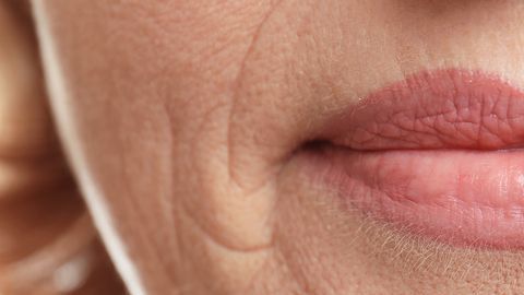 arrugas-en-los-labios