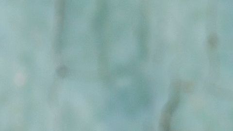 La glándula tiroides es la responsable de controlar el metabolismo, por ello es indispensable en la revisiones médicas para bajar de peso.